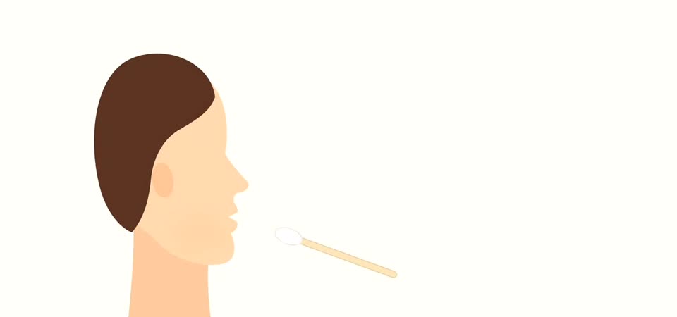 用棉棒刷口腔內側採檢